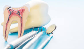 Endodontic Treatment